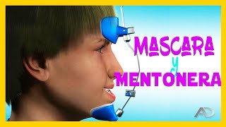 🔺️MENTONERA ortodoncia Y MASCARA FACIAL ortodoncia🔺️PROGNATISMO MANDIBULAR [upl. by Ahsemrac]