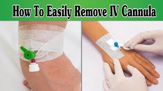 IV Cannula Removal Procedure  Tips and Tricks [upl. by Nivel827]