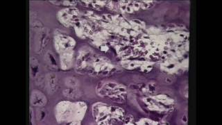 Practical Exam segment from Bone DVD 6 in the Visual Histology DVD Series wwwvisualhistologycom [upl. by Gaige]