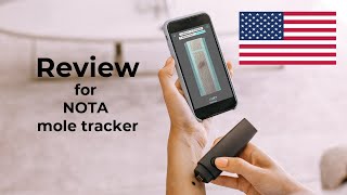 NOTA review Personal mole tracker [upl. by O'Carroll453]