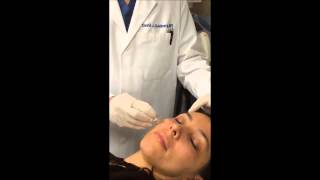 Micro Botox using AQUAGOLD® fine touch™ by Dr David Goldberg [upl. by Mellette613]