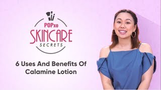 6 Uses And Benefits Of Calamine Lotion  POPxo Skincare Secrets [upl. by Zrike504]