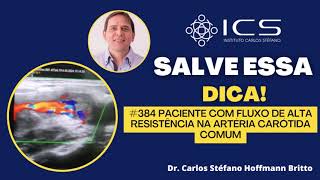 Paciente com fluxo de alta resistência na artéria carótida comum [upl. by Harraf]