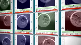 EmbryoScope® Timelapse System [upl. by Coppola]