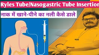 ryles tube insertion nasogastric tube insertion hindi technique NG Tube RT Insertion Dr Satish [upl. by Yllah]