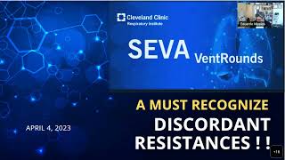 SEVA VentRounds Express A MUST RECOGNIZE  Discordant Loads [upl. by Vivica963]