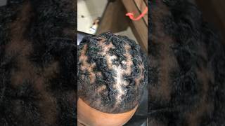 Dreadlocks retwist viralvideo dreadlocks viralshorts shortvideo shorts trending short video [upl. by Eva]