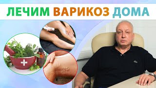 Как вылечить варикоз Чего делать нельзя [upl. by Vanden]