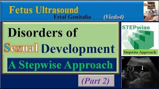 Fetus Ultrasound Disorders of Sexual Development Part2 [upl. by Xer]