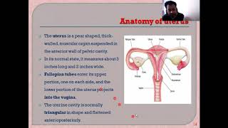 IUD Lecture 1 I Intrauterine Drug Delivery Systems I [upl. by Norrat]