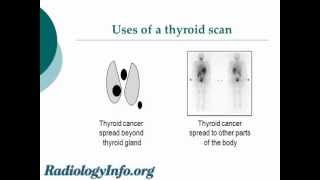 Your Radiologist Explains Thyroid Gland and Scan [upl. by Ynnad487]