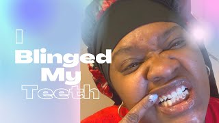 🦷💎 I blinged My Teeth 🦷💎 Gemzeez DIY Tooth Gem Kit Bling Queen [upl. by Roehm29]