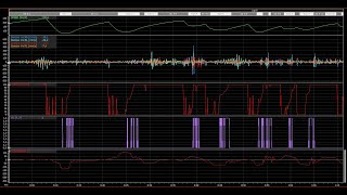 ACC  Special Event  Lambo EVO  Hungary P1  Telemetry amp Setup [upl. by Mctyre]