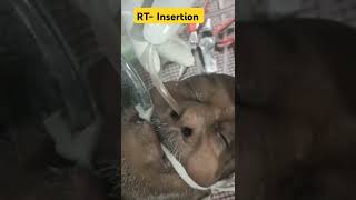 RT Ryles Tube insertion is simple way drsatyampathak rt motivation medicotips viral [upl. by Ariam]