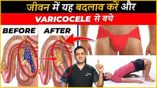 10 Lifestyle changes to stop growing varicocele  Dr Gaurav Gangwani Interventional Radiologist [upl. by Enyar908]