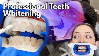 Teeth Whitening At The Dentist  Fastest Way To Whiten Your Teeth [upl. by Theron]