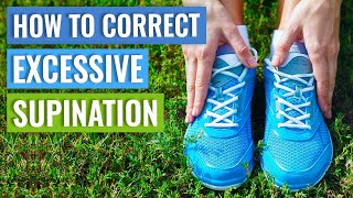 How To Correct Supination  Supination Exercises [upl. by Caty135]