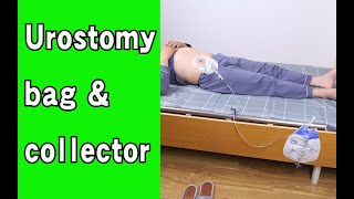 How to use one piece systerm Urostomy bag [upl. by Eibor]