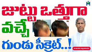 జుట్టు ఒత్తుగా పెరిగే గుండు టెక్నిక్ Hair Growth Manthena Satyanarayana Raju Videos HealthMantra [upl. by Eramal]