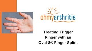 How to Treat a Trigger Finger with an Oval8 Finger Splint  Oh My Arthritis [upl. by Ettessil528]