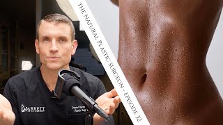 32 Everything You Need To Know About Liposuction [upl. by Scheers]