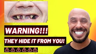 How To Stop Gum Recession From Getting Worse MINERAL TRICK 5 SECONDS [upl. by O'Rourke]