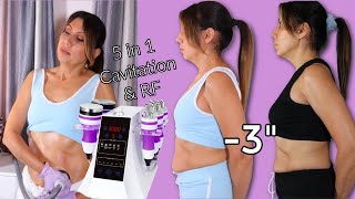 HONEST REVIEW At home Claire 5 In 1 Cavitation Machine  Before And After Results  Surebeauty [upl. by Mahalia]