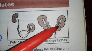 Kidney development embryology 2NDYEARMBBS short notes ❤️ [upl. by Santoro210]