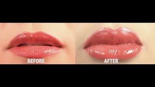 How To Get BIG LUSCIOUS LIPS without lip collagen injections [upl. by Anitrebla]