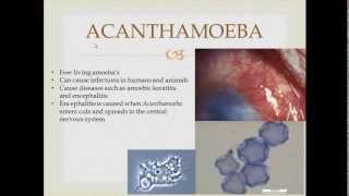 Parasitology Acanthamoeba [upl. by Aissyla]