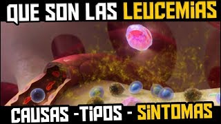 QUE ES LA LEUCEMIA  TIPOS SINTOMAS CAUSAS Y TRATAMIENTO [upl. by Anelahs]