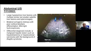 Alagille syndrome and genetic diagnosis of cholestasis in infants  Dr E Elkhatiali [upl. by Rachael]