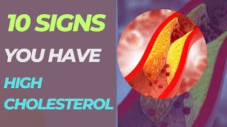 10 Signs You Have High Cholesterol [upl. by Queen]