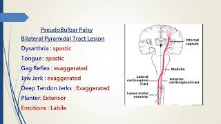 Pseudobulbar Palsy [upl. by Angrist]