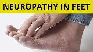 Peripheral Neuropathy Treatment  9 Tips On How to Handle Neuropathy in Feet [upl. by Tait788]