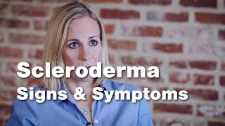 Signs and Symptoms of Scleroderma  Johns Hopkins [upl. by Zoe70]