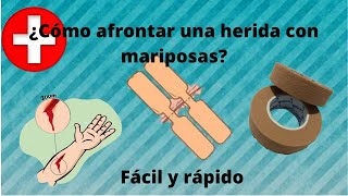 ¿cómo afrontar una herida con mariposas  Heridas  Enfermería [upl. by Murial]