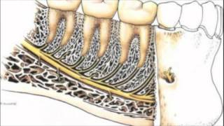 Rapports anatomiques de la troisième molaire mandibulaire [upl. by Kcirttap933]