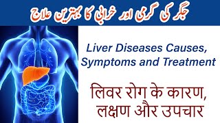 Natural Home Remedies to Detoxify your Liver  Jigar ki kharabi ki alamat or ilaj  लीवर रोग का इलाज [upl. by Wilhide480]