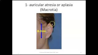 Diseases of the auricle [upl. by Vittorio656]