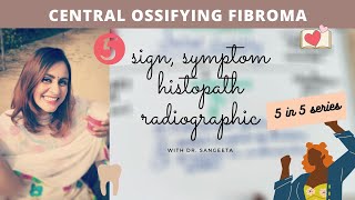 central ossifying fibroma I oral path [upl. by Ilario]