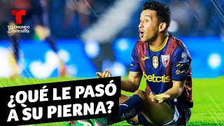 Christian “Hobbit” Bermúdez sufre una horrible lesión en México  Telemundo Deportes [upl. by Mag]