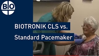 Comparing Heart Rate Regulation BIOTRONIK CLS vs Standard Pacemaker [upl. by Laersi]