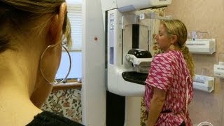 3D mammograms detect more breast cancers study shows [upl. by Ohcamac]