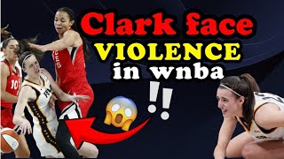 😱💔why is Caitlyn Clark targeted by Aggressive Tactics⁉️ Analyzing full attack‼ [upl. by Mercado831]