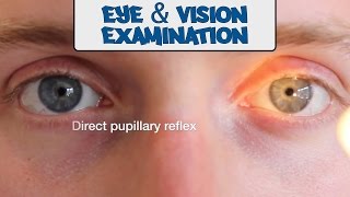 Examination of the Eyes and Vision  OSCE Guide old version  UKMLA  CPSA [upl. by Crompton]