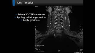 ISMRM MR Academy  MR Neurography [upl. by Maker551]