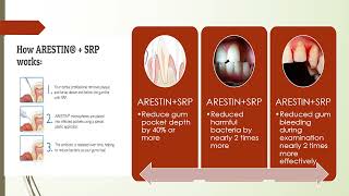 ArestinPeriodontal Therapy [upl. by Ecaidnac]