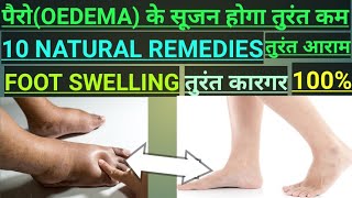 oedemaपैरों में सूजन तुरंत आराम।10 घरेलू नुस्खे।FOOT SWELLING।Edema।causes। treatment। तुरंत आराम। [upl. by Edgell328]