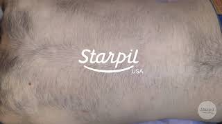 How to Wax Mens Back Hair  Full Back Hair Removal  Starpil Wax [upl. by Kroo]